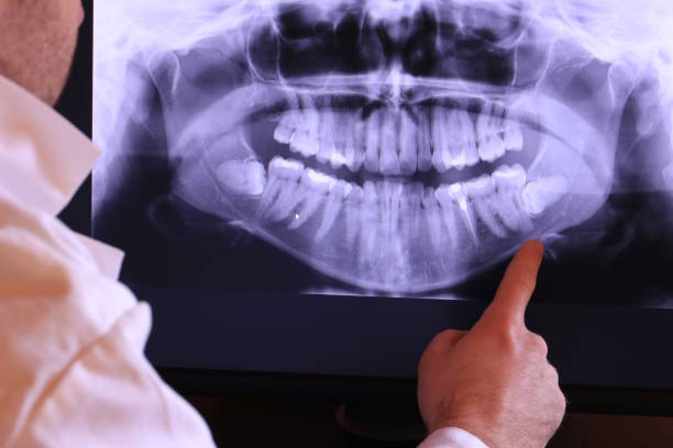 Best Urgent Care for Lost Fillings or Crowns in Grandview, TX