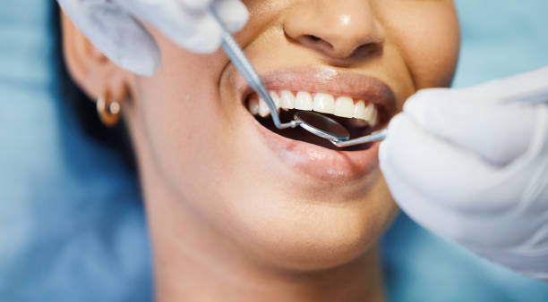 Best Emergency Treatment for Dental Infections or Abscesses in Grandview, TX